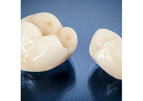 Teeth Straightening Brisbane