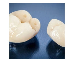 Teeth Straightening Brisbane