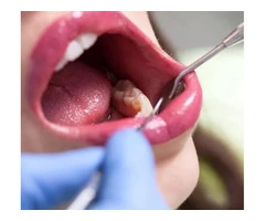 Achieve the Smile of your Dreams with General Dentistry in Banksia Grove