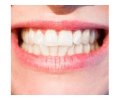 Cosmetic Dentistry Donvale