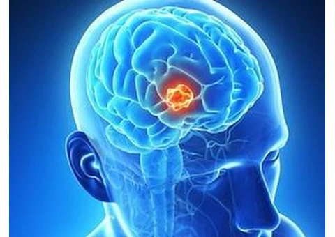 Advanced Vascular Neurosurgery