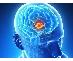 Advanced Vascular Neurosurgery