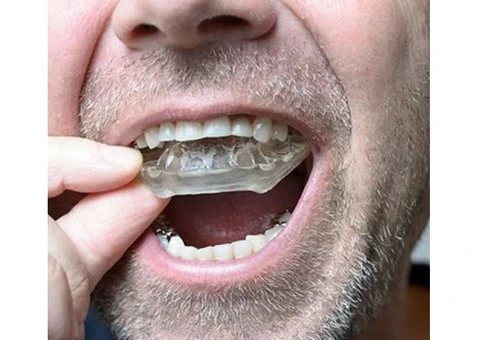 Custom Mouthguards Gosnells by Quick Denture Repair