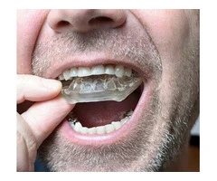 Custom Mouthguards Gosnells by Quick Denture Repair