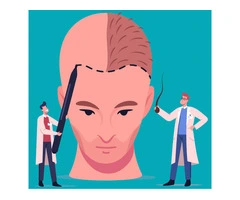 Discover the Best Hair Loss Treatment for Men with IHLS Australia