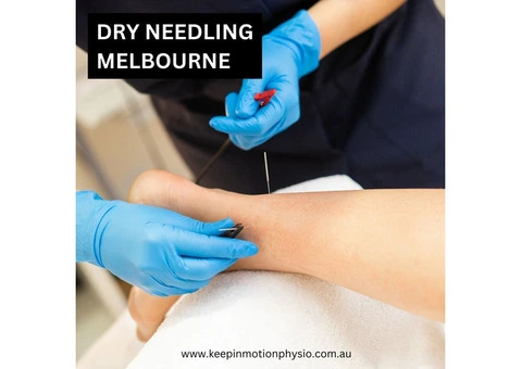 Dry Needling So Popular in Melbourne?
