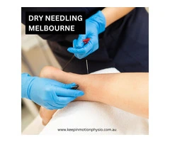 Dry Needling So Popular in Melbourne?