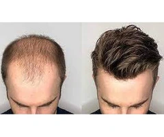 Budget-Friendly Solutions: Exploring Cheap Men's Hairpieces for Every Need