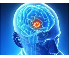 Consult Melbourne’s Leading Brain Specialist – Ivan Bhaskar