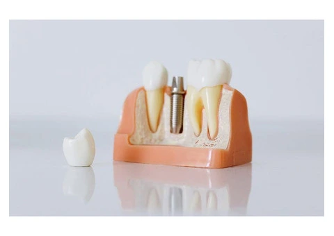 BUPA Dental Brisbane