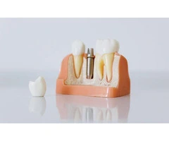 BUPA Dental Brisbane