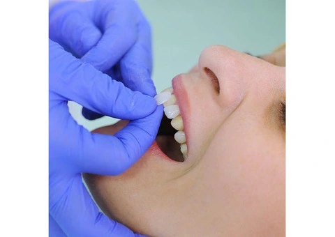 Dental Implants Toowong