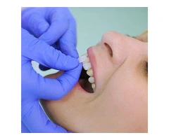 Dental Implants Toowong