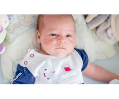 Learn About Childhood Rashes with Early Childhood Education Byford