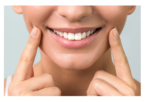 Brighten Your Smile with Professional Teeth Whitening at Smiles On Chapel