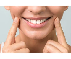 Brighten Your Smile with Professional Teeth Whitening at Smiles On Chapel
