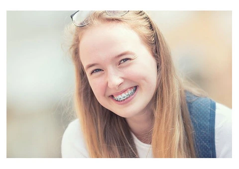 Best Invisalign Deals in Melbourne CBD