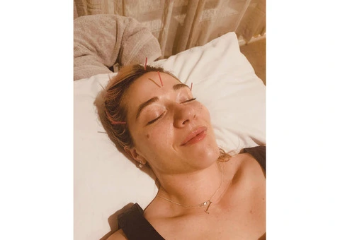 Revitalize Your Body at Acupuncturist Clinic in Gerringong - 2/4