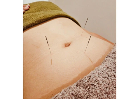 Revitalize Your Body at Acupuncturist Clinic in Gerringong - 4/4