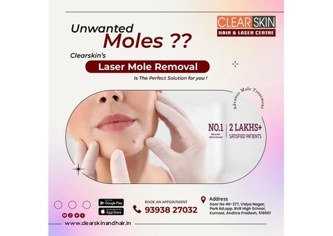 Laser treatment clinic in kurnool