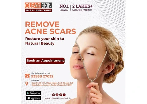 best laser treatment clinic in kurnool