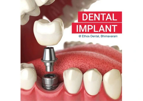 Teeth Straightening Brisbane
