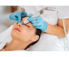 Best Laser Tattoo Removal Treatment in Kirribilli and Tamworth