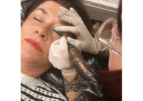 Anti-Aging Skin Treatment at Cosmetic Tattooing Melbourne - 2/2