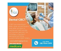 Butler Medical Imaging offers Most Trusted Dental CBCT services.(08) 9544 3999