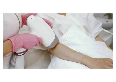 Unveiling the Benefits of SHR Permanent Hair Removal in Perth