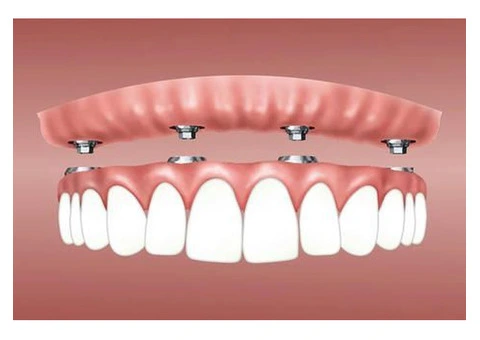 Teeth Whitening Specials in Melbourne CBD