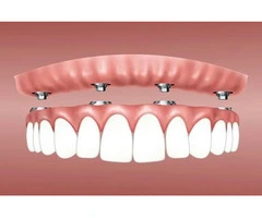 Teeth Whitening Specials in Melbourne CBD