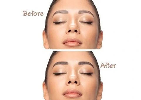 Eyebrow Lamination | Brow Lamination Treatment | Waxing Queen Salon