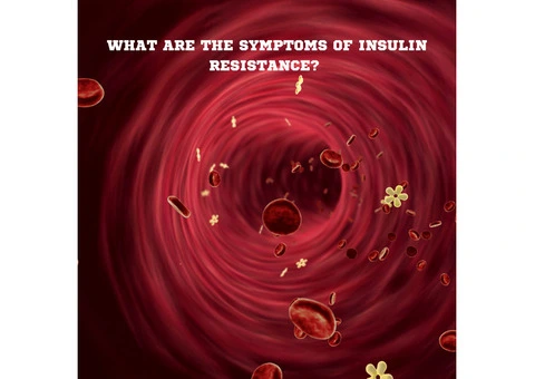 What are the symptoms of insulin resistance?