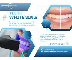Cosmetic Whitening Treatment: Experience the Best Teeth Whitening in Sydney CBD