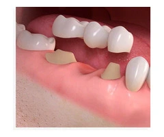 Expert Dental Care and Emergency Dentistry Services in Banksia Grove