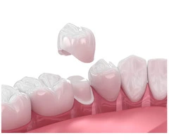 Trusted Children's Dentist in Chatswood