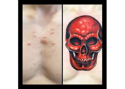 Tattoo Cover-Ups: Revitalize Your Ink at Art N Soul Tattoo Studio