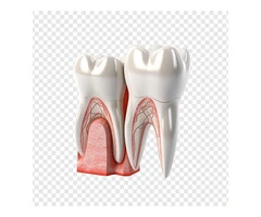 Affordable and Expert Root Canal Treatment at United Dental Clinic
