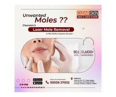 best laser treatment clinic in india