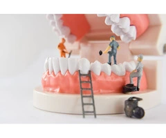 Dental Implants Campbelltown