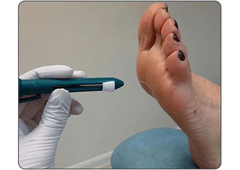 The Most Reliable Foot Clinic in Highett