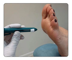 The Most Reliable Foot Clinic in Highett