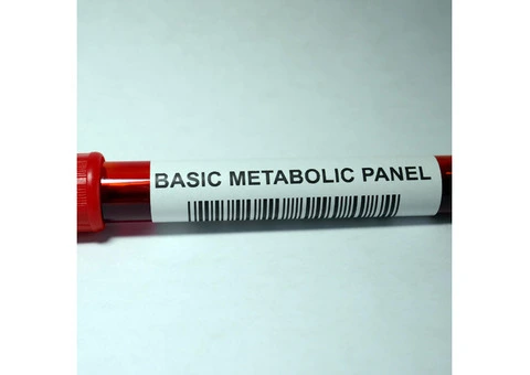 Key Types of Blood Tests You Should Know About - 1/6