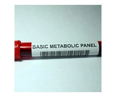 Key Types of Blood Tests You Should Know About