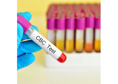 Key Types of Blood Tests You Should Know About - 2/6