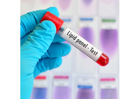 Key Types of Blood Tests You Should Know About - 3/6