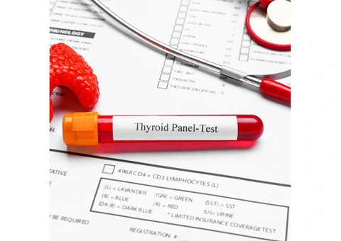 Key Types of Blood Tests You Should Know About - 4/6