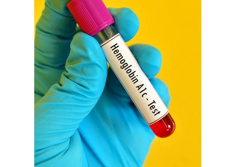 Key Types of Blood Tests You Should Know About - 5/6