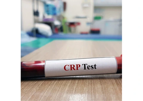 Key Types of Blood Tests You Should Know About - 6/6